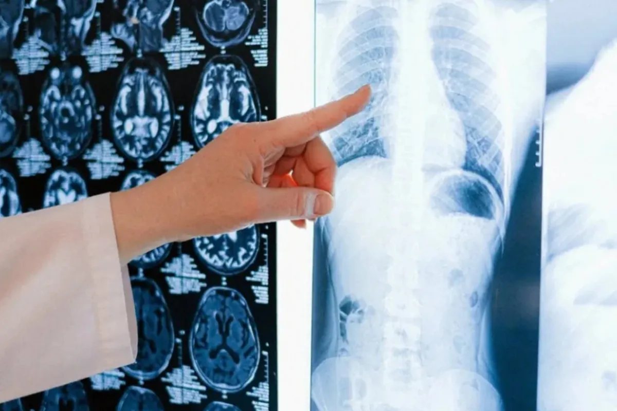 It could be the scientific news of the year: two bacteria with antitumor effects discovered that could change the fight against cancer forever