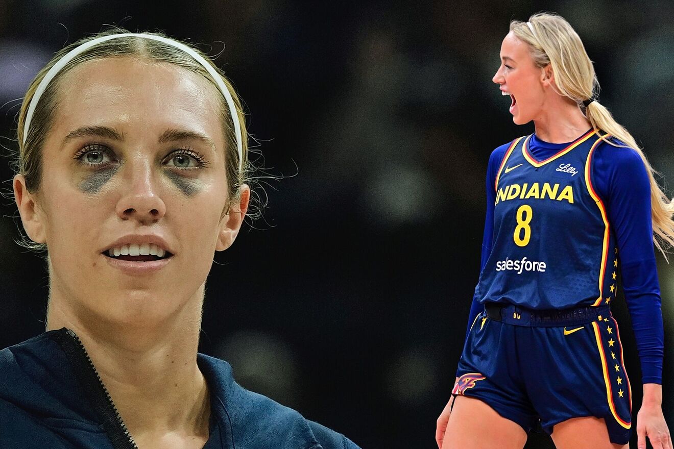 Sophie Cunningham&apos;s incredible explanation of Lexie Hull&apos;s black eyes